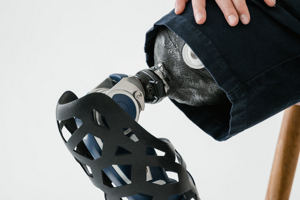 義肢定制 義肢定制